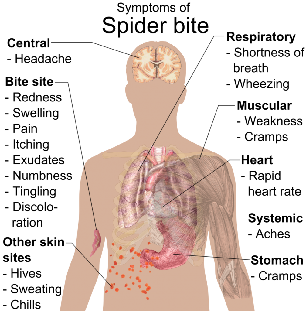 can-a-spider-bite-cause-muscle-pain-pestphobia