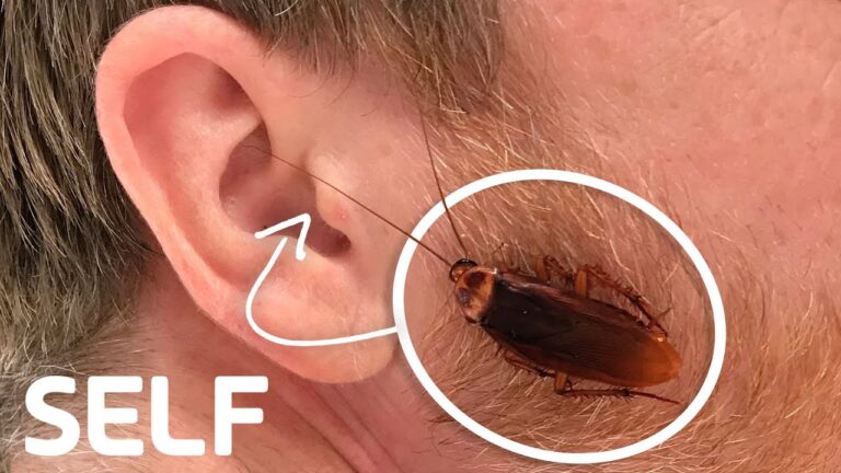 can-cockroaches-go-in-your-ear-pest-phobia