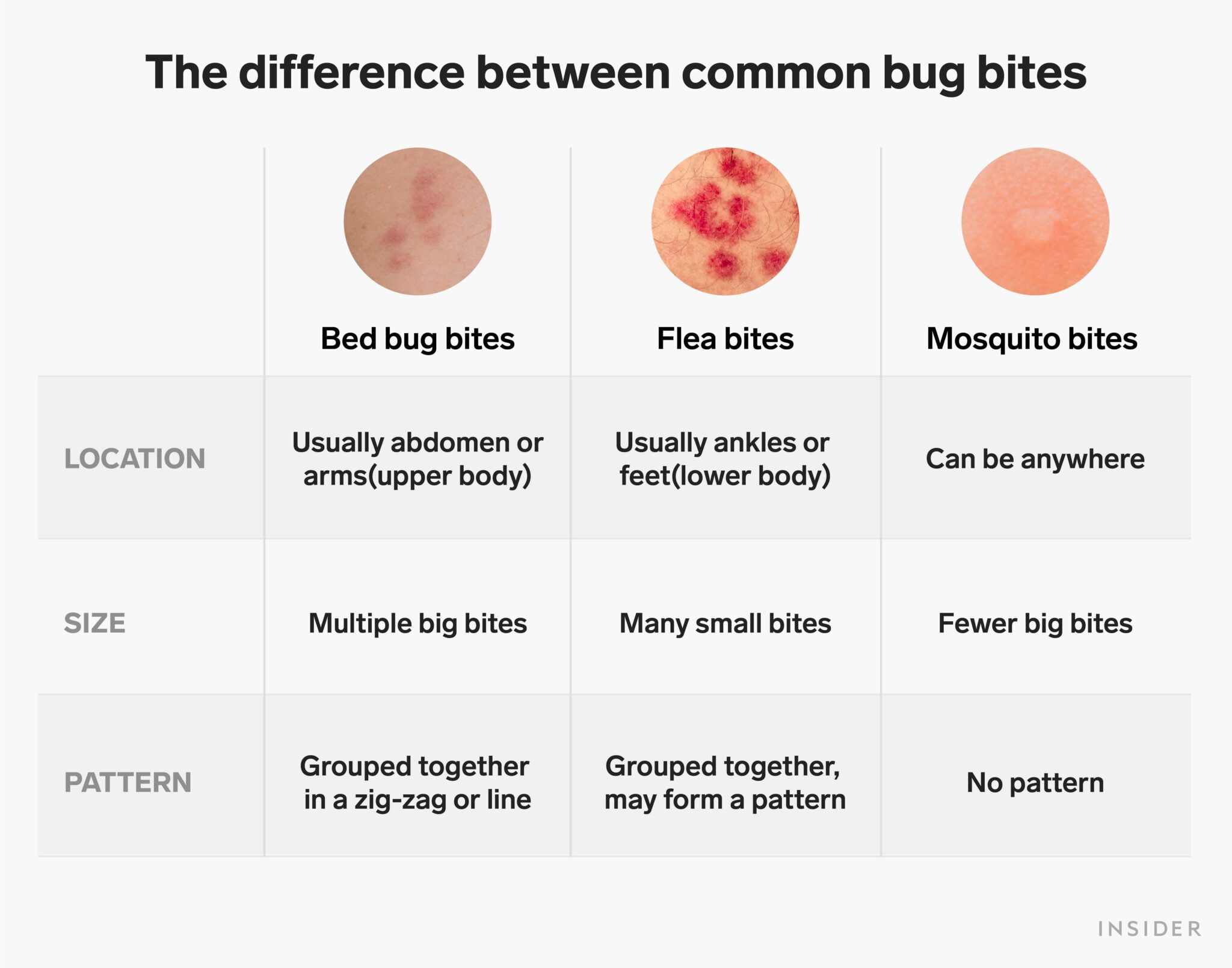 Do Bed Bug Bites Go Away Pest Phobia