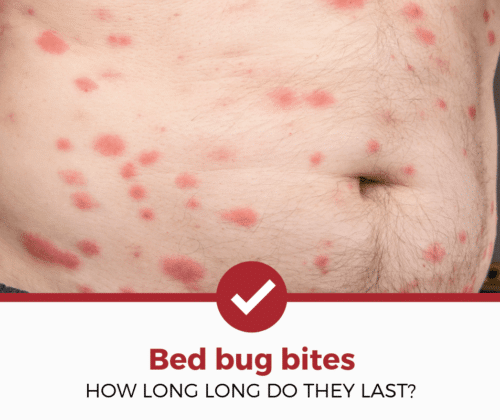 how-quickly-do-bed-bug-bites-go-away-pest-phobia